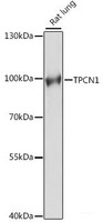 Western blot analysis of extracts of Rat lung using TPCN1 Polyclonal Antibody at dilution of 1:1000.