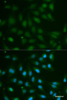 Immunofluorescence analysis of MCF-7 cells using ABO Polyclonal Antibody