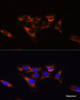 Immunofluorescence analysis of C6 cells using ADORA2A Polyclonal Antibody at dilution of 1:100. Blue: DAPI for nuclear staining.