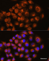 Immunofluorescence analysis of HeLa cells using ADORA2A Polyclonal Antibody at dilution of 1:100. Blue: DAPI for nuclear staining.