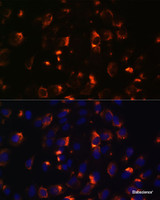 Immunofluorescence analysis of C6 cells using CCDC47 Polyclonal Antibody at dilution of 1:100. Blue: DAPI for nuclear staining.