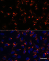 Immunofluorescence analysis of U-2 OS cells using CCDC47 Polyclonal Antibody at dilution of 1:100. Blue: DAPI for nuclear staining.