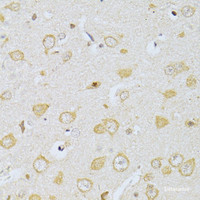 Immunohistochemistry of paraffin-embedded Rat brain using CHRNA7 Polyclonal Antibody at dilution of 1:100 (40x lens) .