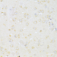 Immunohistochemistry of paraffin-embedded Mouse brain using CHRNA7 Polyclonal Antibody at dilution of 1:100 (40x lens) .