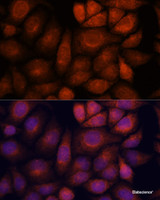 Immunofluorescence analysis of HeLa cells using KIF13A Polyclonal Antibody at dilution of 1:100. Blue: DAPI for nuclear staining.