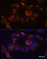 Immunofluorescence analysis of C6 cells using ATL2 Polyclonal Antibody at dilution of 1:100. Blue: DAPI for nuclear staining.