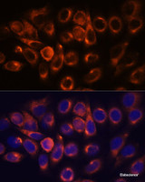 Immunofluorescence analysis of HeLa cells using ATL2 Polyclonal Antibody at dilution of 1:100. Blue: DAPI for nuclear staining.