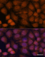 Immunofluorescence analysis of HeLa cells using CEP85 Polyclonal Antibody at dilution of 1:100. Blue: DAPI for nuclear staining.