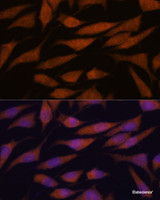 Immunofluorescence analysis of L929 cells using DDX31 Polyclonal Antibody at dilution of 1:100. Blue: DAPI for nuclear staining.