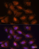 Immunofluorescence analysis of C6 cells using UPF3A Polyclonal Antibody at dilution of 1:100. Blue: DAPI for nuclear staining.
