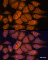 Immunofluorescence analysis of HeLa cells using UPF3A Polyclonal Antibody at dilution of 1:100. Blue: DAPI for nuclear staining.