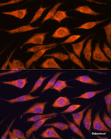 Immunofluorescence analysis of L929 cells using UPF3A Polyclonal Antibody at dilution of 1:100. Blue: DAPI for nuclear staining.