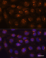 Immunofluorescence analysis of C6 cells using B3GNT4 Polyclonal Antibody at dilution of 1:100. Blue: DAPI for nuclear staining.
