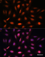 Immunofluorescence analysis of U-2 OS cells using PPIL4 Polyclonal Antibody at dilution of 1:100. Blue: DAPI for nuclear staining.