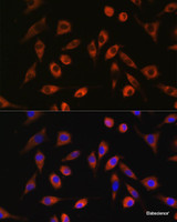 Immunofluorescence analysis of L929 cells using TP53I13 Polyclonal Antibody at dilution of 1:100. Blue: DAPI for nuclear staining.