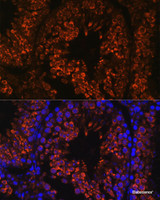 Immunofluorescence analysis of Mouse testis using FER1L5 Polyclonal Antibody at dilution of 1:100. Blue: DAPI for nuclear staining.