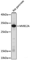 Western blot analysis of extracts of Rat pancreas using MVB12A Polyclonal Antibody at dilution of 1:1000.