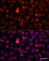 Immunofluorescence analysis of HeLa cells using N4-Methylcytidine Polyclonal Antibody at dilution of 1:100 (40x lens) . Blue: DAPI for nuclear staining.