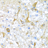 Immunohistochemistry of paraffin-embedded Rat brain using SULT1A1 Polyclonal Antibody at dilution of 1:100 (40x lens) .