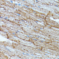 Immunohistochemistry of paraffin-embedded Rat heart using SLC14A1 Polyclonal Antibody at dilution of 1:100 (40x lens) .