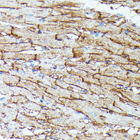 Immunohistochemistry of paraffin-embedded Mouse heart using SLC14A1 Polyclonal Antibody at dilution of 1:100 (40x lens) .