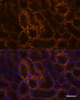 Immunofluorescence analysis of Mouse kidney using SLC14A1 Polyclonal Antibody at dilution of 1:100. Blue: DAPI for nuclear staining.