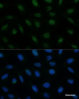 Immunofluorescence analysis of U-2 OS cells using CENPA Polyclonal Antibody at dilution of 1:100 (40x lens) . Blue: DAPI for nuclear staining.