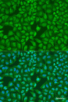 Immunofluorescence analysis of U2OS cells using MonoMethyl-UHRF1-K385 Polyclonal Antibody at dilution of 1:100. Blue: DAPI for nuclear staining.