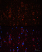 Immunofluorescence analysis of Rat brain using LAMC1 Polyclonal Antibody at dilution of 1:100. Blue: DAPI for nuclear staining.
