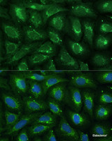 Immunofluorescence analysis of U-2 OS cells using ABCD2 Polyclonal Antibody at dilution of 1:100 (40x lens) . Blue: DAPI for nuclear staining.