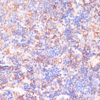 Immunohistochemistry of paraffin-embedded Rat spleen using CACNB2 Polyclonal Antibody at dilution of 1:100 (40x lens) .