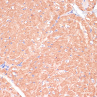 Immunohistochemistry of paraffin-embedded Mouse heart using CACNB2 Polyclonal Antibody at dilution of 1:100 (40x lens) .