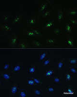 Immunofluorescence analysis of U-2 OS cells using HNF4G Polyclonal Antibody at dilution of 1:100 (40x lens) . Blue: DAPI for nuclear staining.