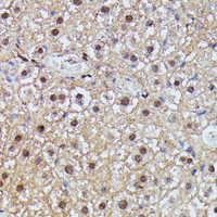 Immunohistochemistry of paraffin-embedded Mouse liver using IGHMBP2 Polyclonal Antibody at dilution of 1:100 (40x lens) .