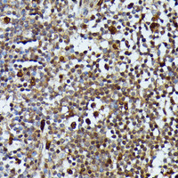 Immunohistochemistry of paraffin-embedded Human appendix using MAP3K3 Polyclonal Antibody at dilution of 1:100 (40x lens) .