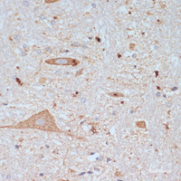 Immunohistochemistry of paraffin-embedded Rat brain using SLC18A3 Polyclonal Antibody at dilution of 1:200 (40x lens) .