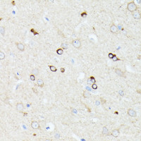 Immunohistochemistry of paraffin-embedded Rat brain using CCDC6 Polyclonal Antibody at dilution of 1:100 (40x lens) .