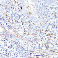 Immunohistochemistry of paraffin-embedded Human appendix using CCDC6 Polyclonal Antibody at dilution of 1:100 (40x lens) .