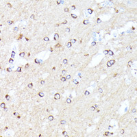 Immunohistochemistry of paraffin-embedded Mouse brain using CCDC6 Polyclonal Antibody at dilution of 1:100 (40x lens) .