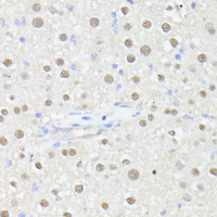 Immunohistochemistry of paraffin-embedded Rat liver using MLF2 Polyclonal Antibody at dilution of 1:100 (40x lens) .