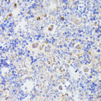 Immunohistochemistry of paraffin-embedded Mouse spleen using MLF2 Polyclonal Antibody at dilution of 1:100 (40x lens) .