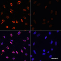 Immunofluorescence analysis of NIH/3T3 cells using Acetyl-Histone H3-K36 Polyclonal Antibody at dilution of 1:100.NIH/3T3 cells were treated by TSA (1 uM) at 37℃ for 18 hours. Blue: DAPI for nuclear staining.