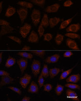 Immunofluorescence analysis of L929 cells using SEC24D Polyclonal Antibody at dilution of 1:100. Blue: DAPI for nuclear staining.