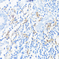 Immunohistochemistry of paraffin-embedded Human appendix using HLA-DRB3 Polyclonal Antibody at dilution of 1:100 (40x lens) .