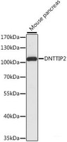 Western blot analysis of extracts of Mouse pancreas using DNTTIP2 Polyclonal Antibody at dilution of 1:1000.