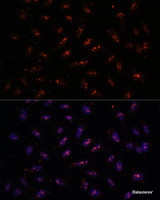 Immunofluorescence analysis of U-2 OS cells using DNTTIP2 Polyclonal Antibody at dilution of 1:100. Blue: DAPI for nuclear staining.