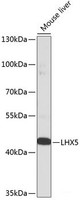 Western blot analysis of extracts of Mouse liver using LHX5 Polyclonal Antibody at dilution of 1:1000.