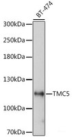 Western blot analysis of extracts of BT-474 cells using TMC5 Polyclonal Antibody at dilution of 1:1000.