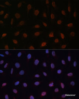 Immunofluorescence analysis of U-2 OS cells using MED25 Polyclonal Antibody at dilution of 1:100 (40x lens) . Blue: DAPI for nuclear staining.