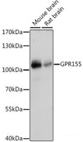 Western blot analysis of extracts of various cell lines using GPR155 Polyclonal Antibody at dilution of 1:1000.